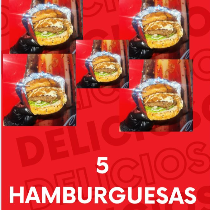 5 HAMBURGUESAS